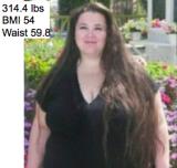 2650Michelle Ab Before.jpg